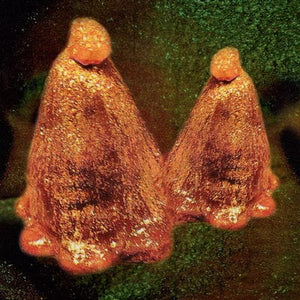 Golden Discs VINYL Oocyte Oil & Stolen Androgens:   - Black to Comm [VINYL]