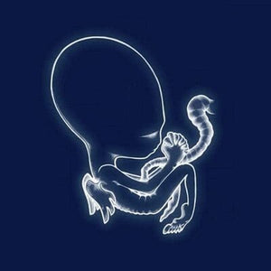 Golden Discs VINYL Ágætis Byrjun - Sigur Rós [VINYL]